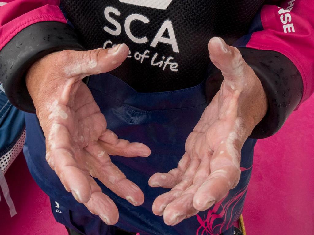 Volvo Ocean Race - October 28, 2014.  Leg 1 onboard Team SCA. What sailing hands look like after 18 days at sea. Abby Ehler. photo copyright Corinna Halloran / Team SCA taken at  and featuring the  class