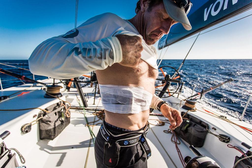 October 14, 2014. Leg 1 onboard Team Vestas Wind: Tony Rae shows his rib injury after 4 days at sea. Team Vestas Wind on the Volvo Ocean Race. © Brian Carlin - Team Vestas Wind