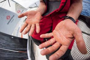 Onboard Dongfeng Race Team – Sailors hands - Leg six to Newport – Volvo Ocean Race 2015 photo copyright  Sam Greenfield / Volvo Ocean Race taken at  and featuring the  class