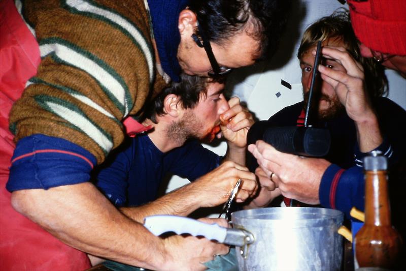Philip stitching his own face after a winch handle rebounded resulting in his tooth going through his lip. His steady hands have left him scar free. The Lea & Perrin sauce was not used in the procedure (1985-86 Race ) - photo © Philip McDonald