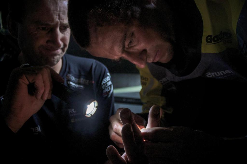 October 11, 2014. Leg 1 onboard Team Brunel.  Louis Balcaen cures Jens Dolmers hand. © Stefan Coppers/Team Brunel