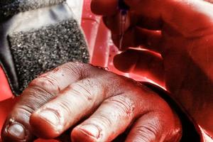 Pascal's injured hand onboard Dongfeng - 2014 Sevenstar Round Britain and Ireland Race photo copyright Dongfeng Race Team taken at  and featuring the  class
