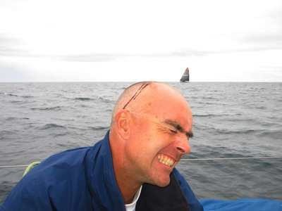 Hopefully, movistar skipper Bouwe Bekking (NED) copped this cut from an on-board accident, and not one of the competitors they passed overnight!  © Volvo Ocean Race http://www.volvooceanrace.com