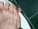 Dove stubbing toes photo copyright SW taken at  and featuring the  class