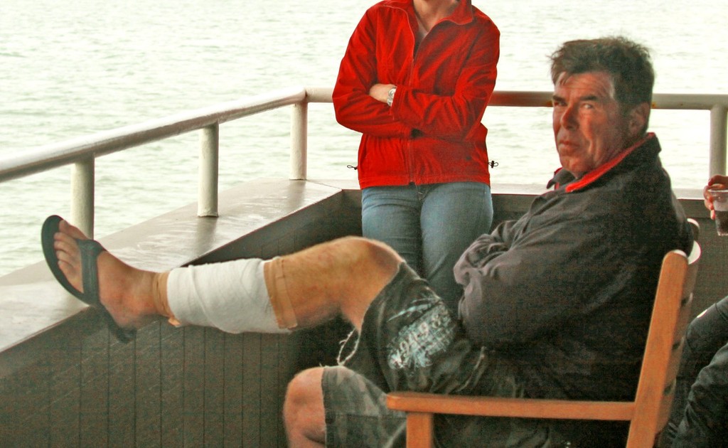 Day 5: 18fters in San Francisco: Graham Catley (NZL) rests a cut leg from the previous day’s racing and was forced to sit out the final day’s racing © Rich Roberts http://www.UnderTheSunPhotos.com