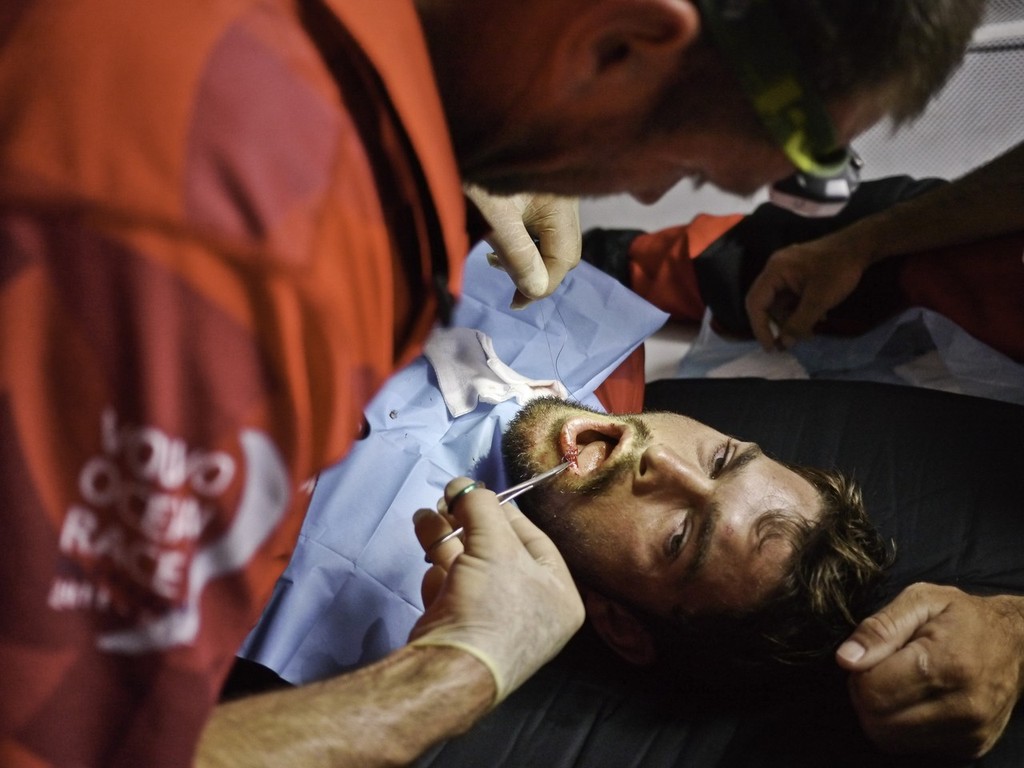 Onboard medic Tony Rae administers  three stitches and anaesthetic to CAMPER with Emirates Team New Zealand bowman Mike Pammenter from South Africa, after suffering a broken tooth and gash to the face in a fall during a sail change, on leg 1 of the Volvo Ocean Race 2011-12, from Alicante, Spain to Cape Town, South Africa.  &copy; Hamish Hooper/Camper ETNZ/Volvo Ocean Race