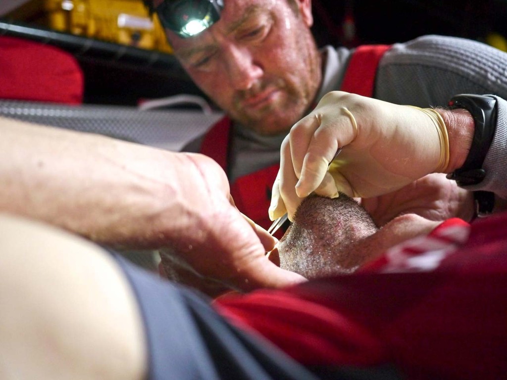 Team Medic Tony Rae removing the oral stitches of Mike Pammenter onboard CAMPER with Emirates Team New Zealand during leg 2 of the Volvo Ocean Race 2011-12, from Cape Town, South Africa to Abu Dhabi, UAE. © Hamish Hooper/Camper ETNZ/Volvo Ocean Race