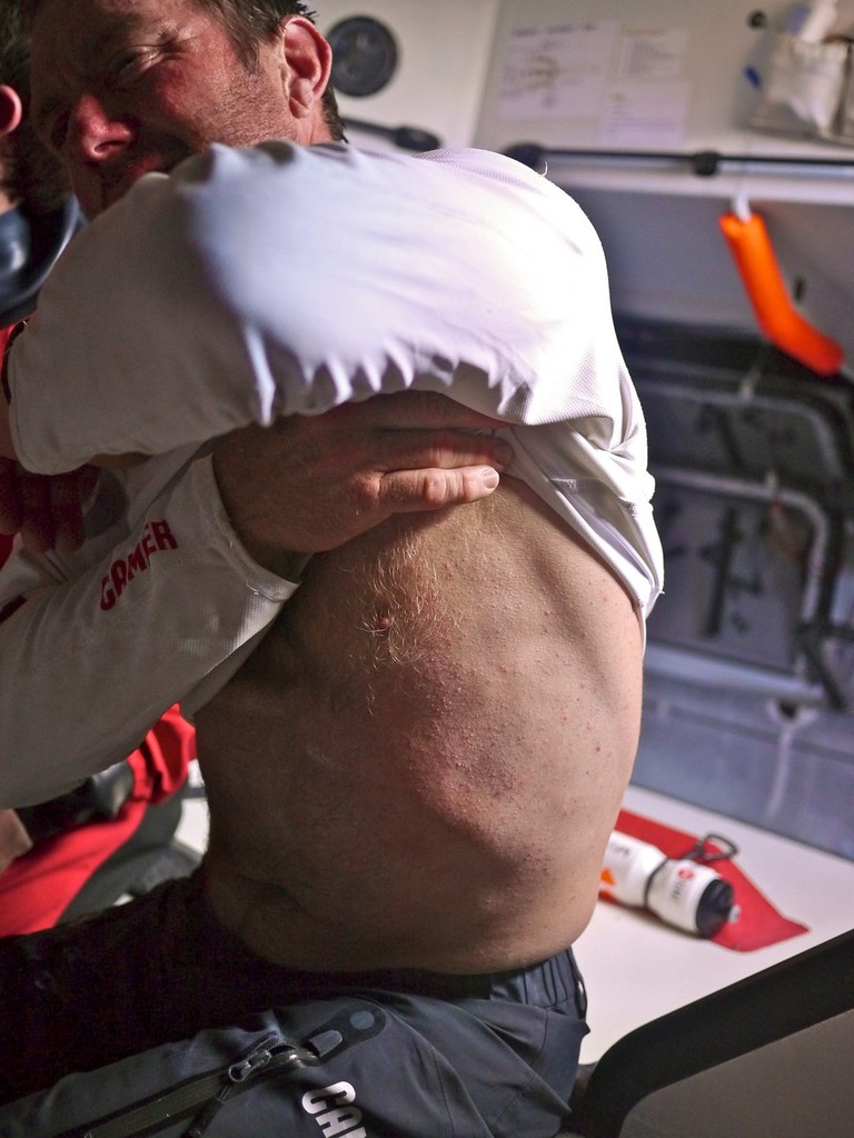 Tony Rae showing the location of his rib injury onboard Camper  during leg 4 of the Volvo Ocean Race 2011-12, from Sanya, China to Auckland, New Zealand.  © Hamish Hooper/Camper ETNZ/Volvo Ocean Race